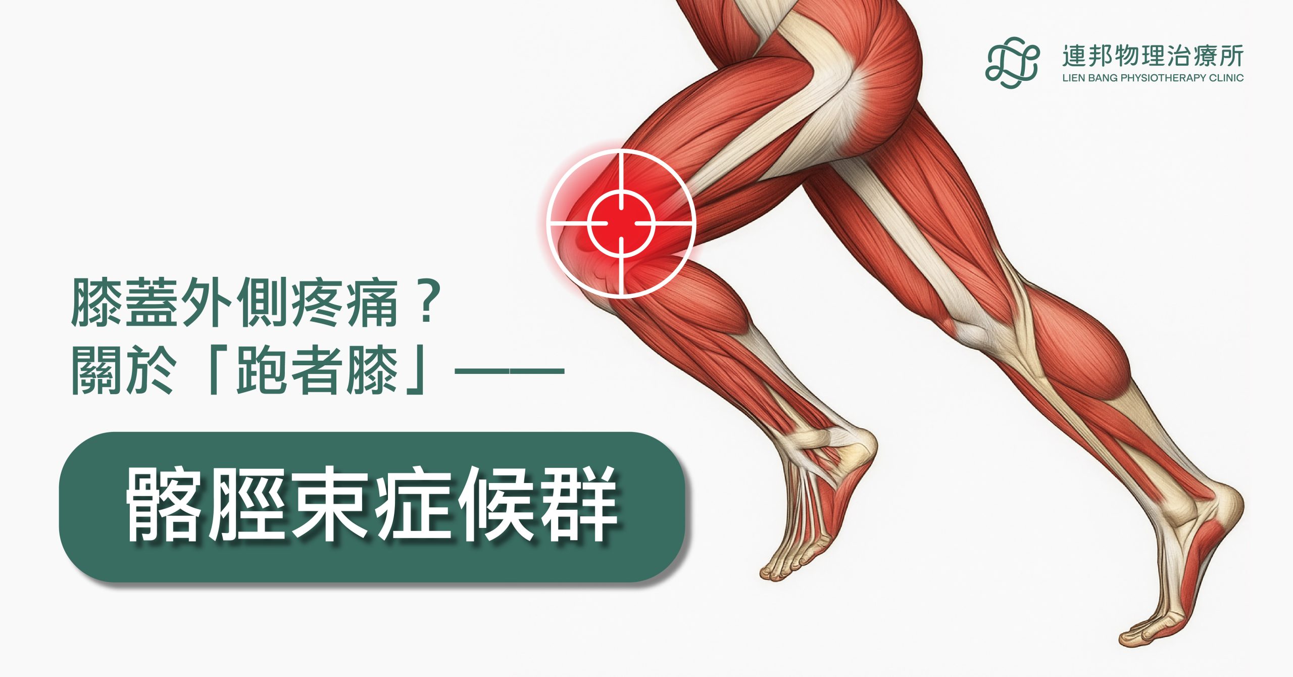 台北物理治療、膝蓋外側痛、跑步膝、過度使用傷害、髂脛束症候群